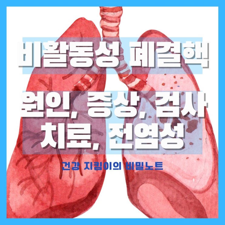  비활동성 폐결핵 전염성, 원인, 증상, 검사, 치료