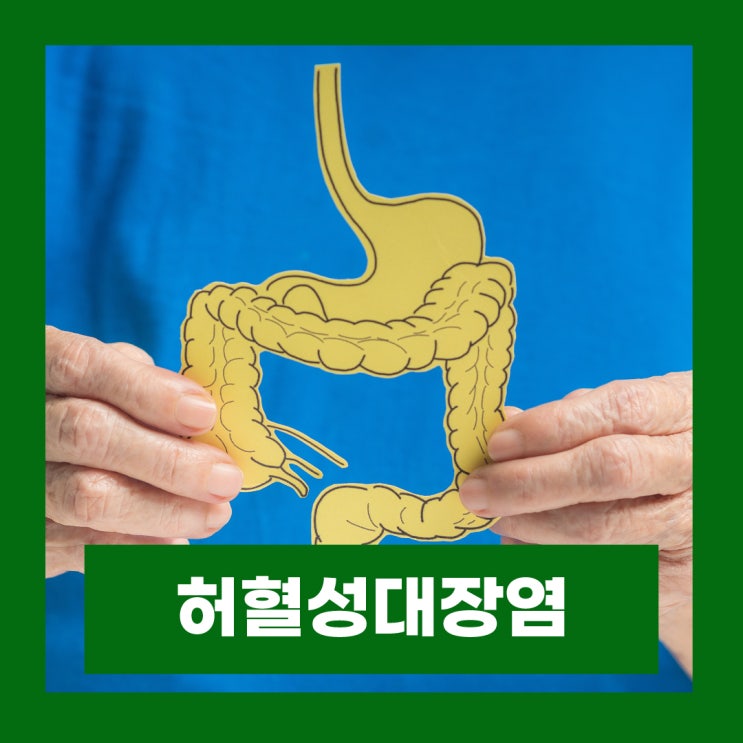  허혈성대장염 원인 왼쪽배복통 급성설사 혈변증상 검사 치료방법