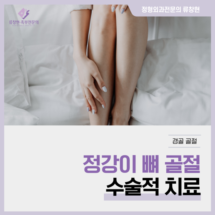  정강이 뼈 골절의 수술적 치료에 대한 모든 것