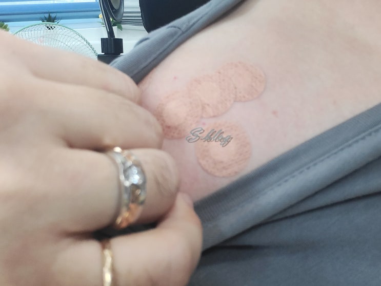  지속되는 왼쪽어깨 통증 원인 모르고 병원부터 가봤어요