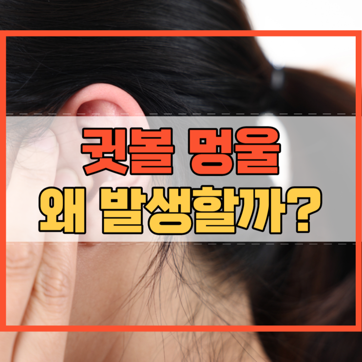  귓볼 멍울 왜 발생할까?