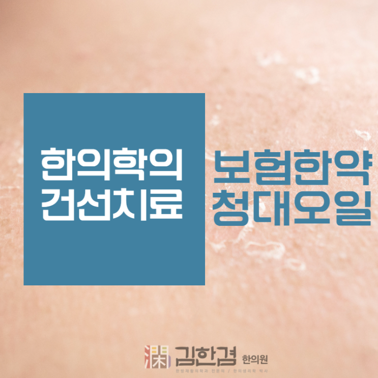  분당 건선 - 보험한약, 침치료, 청대 오일로 증상을 완화할 수 있습니다.