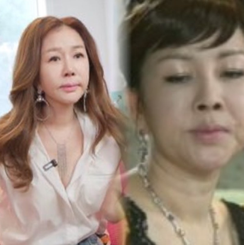 60세 박준금 목주름 시술 가격 효과 관리 후기