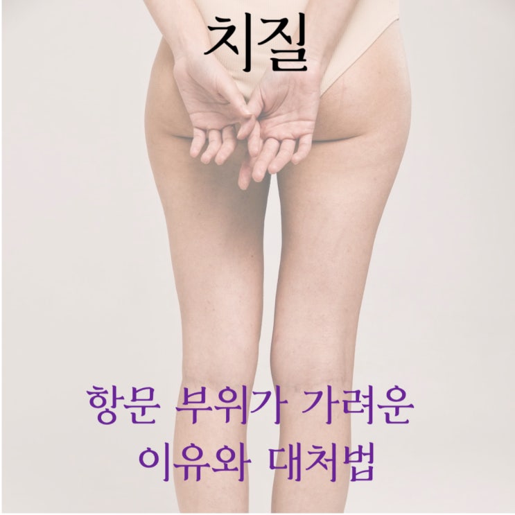  치질 항문 부위가 가려운 이유와 대처법