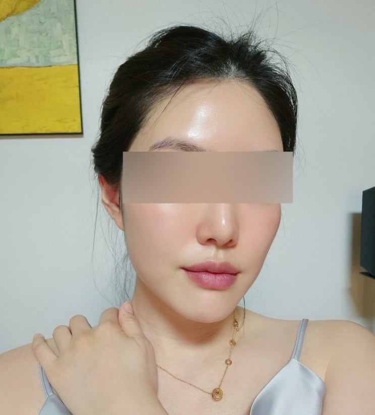 진정 피부관리 10회 후기 키웰 인천구월점/ 구월동에스테틱 진정 피부관리 10회 후기 키웰 인천구월점/ 구월동에스테틱