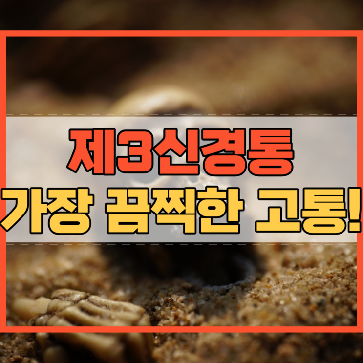  제3신경통 세상에서 가장 끔찍한 고통!