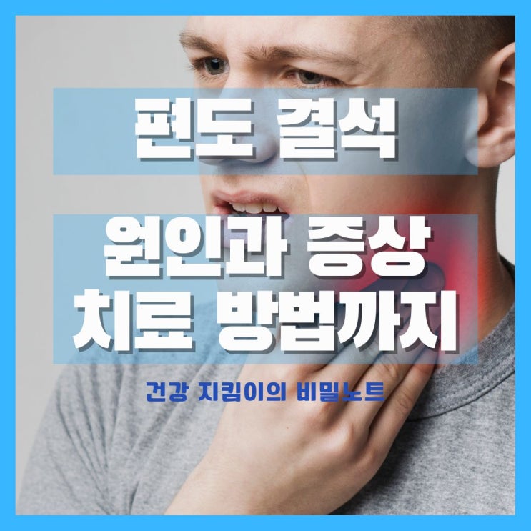  편도결석 원인과 증상, 치료까지