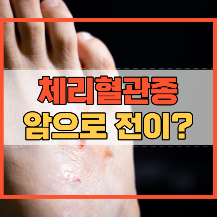  체리혈관종 암으로 전이된다?
