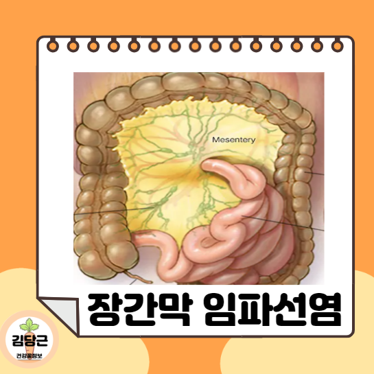 장간막임파선염 장간막림프절염 증상과 소아에게 흔하게 나타나는 이유
