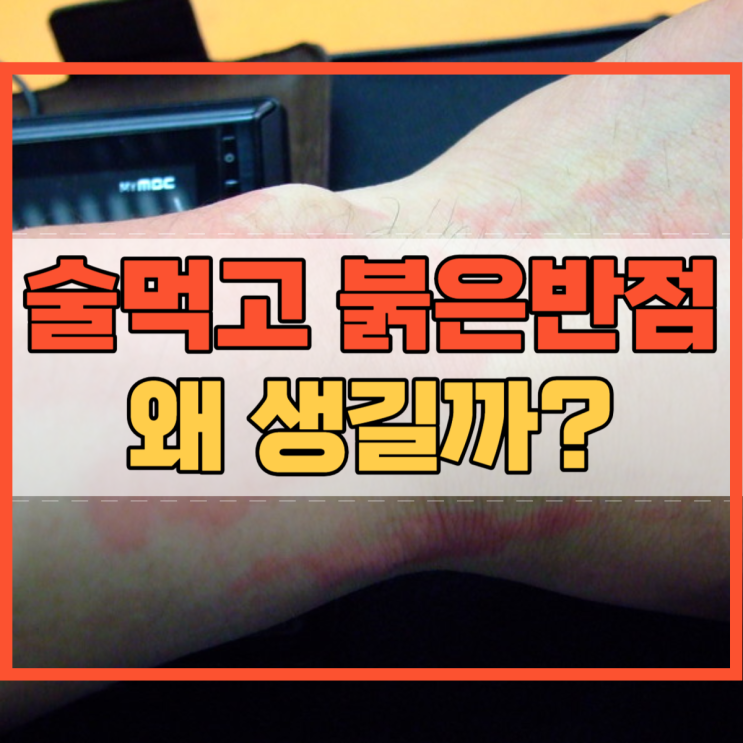  술먹고 붉은반점 왜 생기는 걸까요?