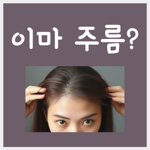  이마주름 없애는 방법, 이 '3가지'만 기억하면 끝납니다