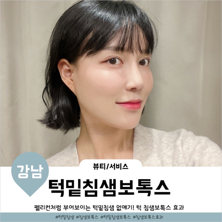  턱 침샘보톡스 효과 4주후 후기 통증, 붓기, 주기