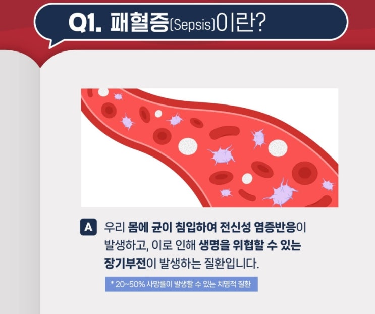 정말 무서운 병 패혈증(Sepsis)’이란?