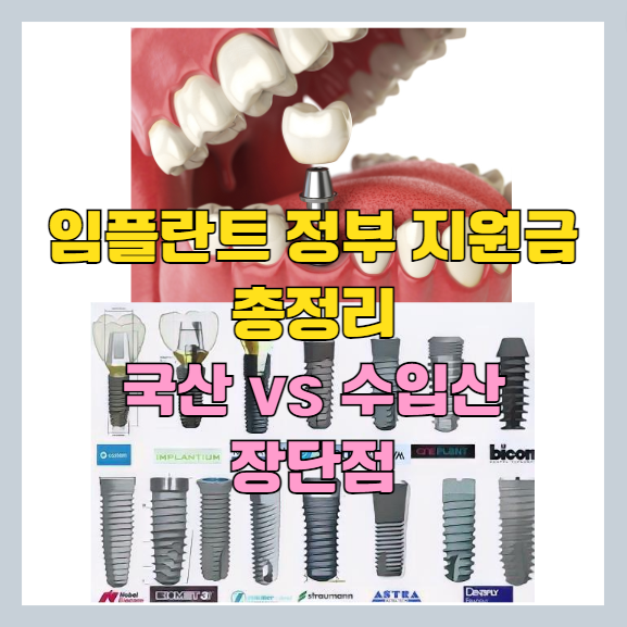  2023 임플란트 1개 가격 비교 | 정부 지원금 | 종류 별 장 단점 총 정리