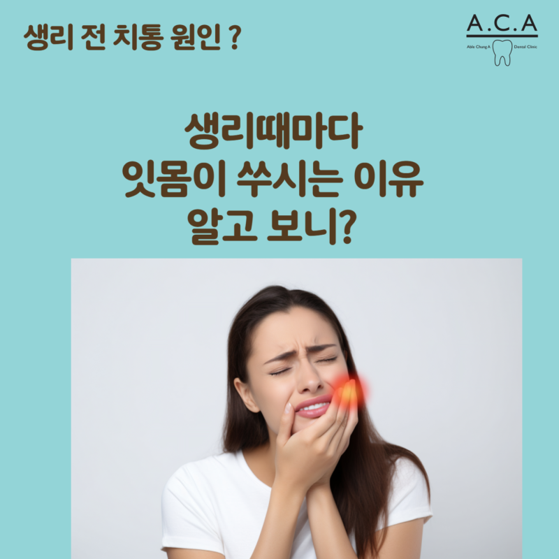 생리전치통 잇몸붓고 아프다면 월경성 치은염?