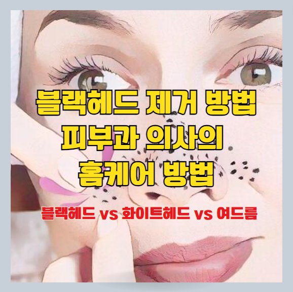  코 블랙 헤드 제거 방법 홈케어 - 피부과 의사의 조언 [피지와 모공 관리 법]