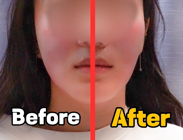서면 리프팅 피부과 가서 후회하기 전 알아야 하는 한 가지 서면 리프팅 피부과 가서 후회하기 전 알아야 하는 한 가지