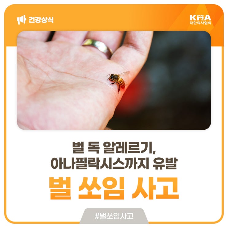  벌 쏘임 사고로 인한 벌 독 알레르기, 아나필락시스까지 유발한다