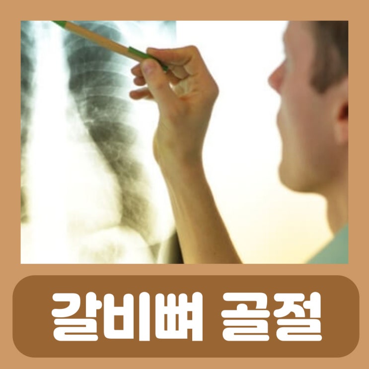  갈비뼈 실금 치료 갈비뼈 실금 금갔을때 골절 증상 치료 왼쪽 오른쪽 갈비뼈 아래 통증