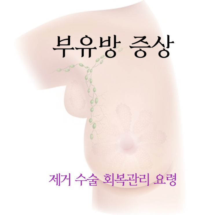  부유방 증상 제거 수술 회복관리 요령