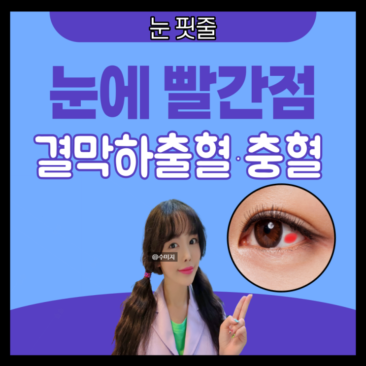  결막하출혈 눈 핏줄터짐 : 한쪽 눈충혈 원인 안약 세라틴 눈에 실 핏줄 눈 따가움 오른쪽 왼쪽 눈통증