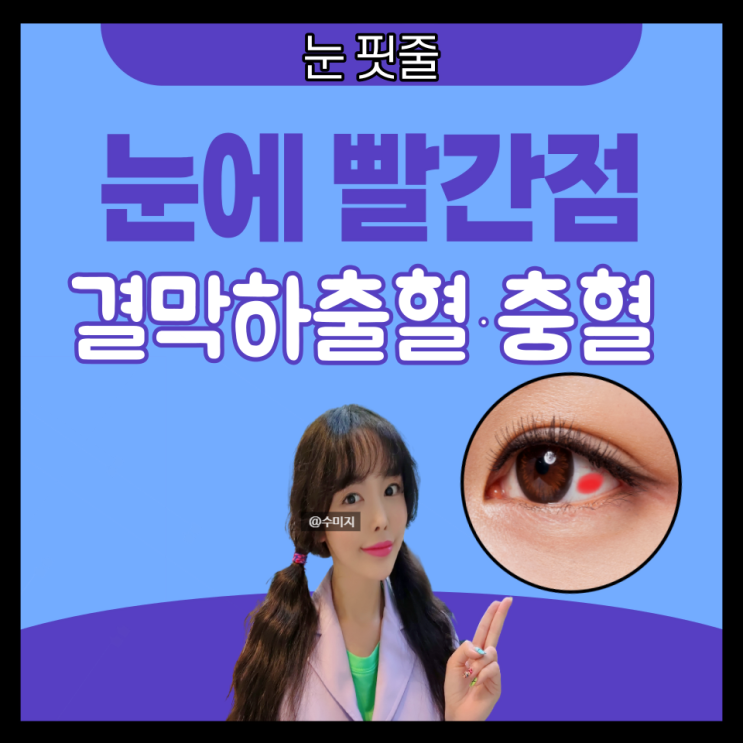 결막하출혈 눈 핏줄터짐 : 한쪽 눈충혈 원인 안약 세라틴 눈에 실 핏줄 눈 따가움 오른쪽 왼쪽 눈통증