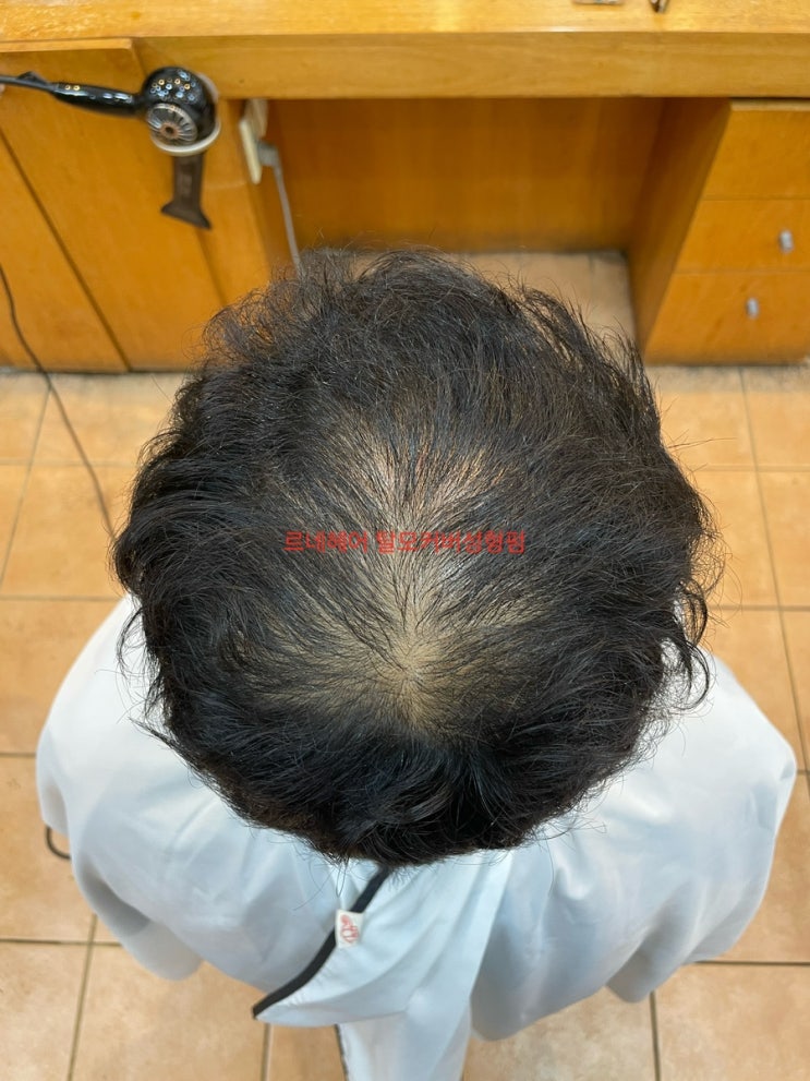  아재az들의mz따라잡기 남자탈모성형펌 부산사상탈모전문미용실 르네시떼헤어/ 감전김해대동덕천용원거제마산창원연산동래명륜장전금정수영해운대장산장유다대명지북항경남경북전남만덕초읍전포남포구덕