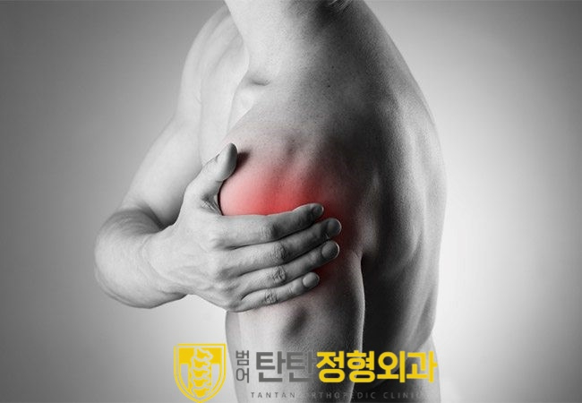  수성구 정형외과 어깨통증 줄여주는 방법