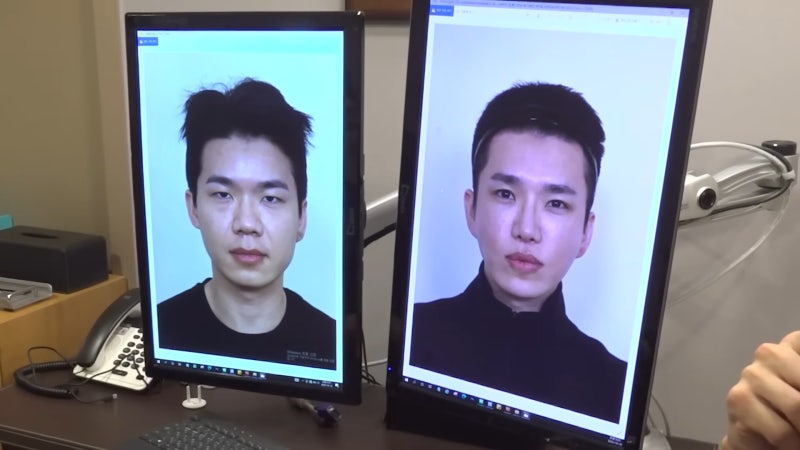 유튜버 보겸 성형하고 돌아왔다.