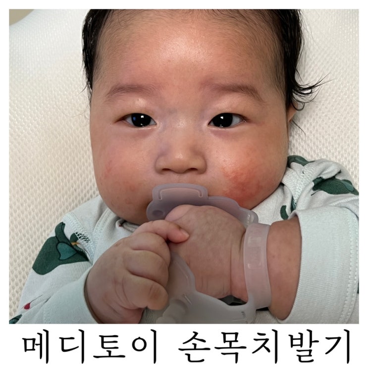 [육아템리뷰]아기 치발기 사용시기 메디토이 손목치발기 추천 : )