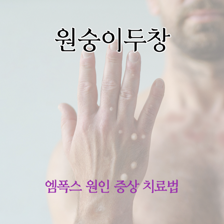  원숭이 두창 엠폭스 원인 증상 치료법