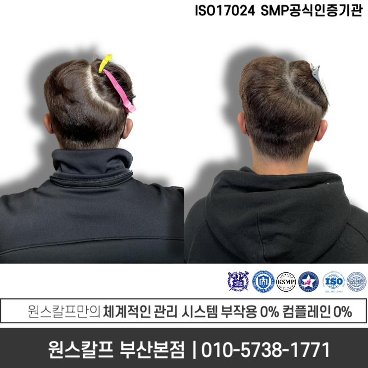  부산흉터커버두피문신, 아무래도 원조는 이곳!