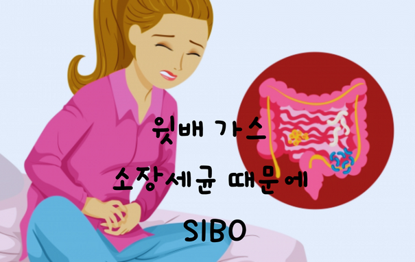  윗배 가스 차면, 나도 혹시 소장세균 때문에? SIBO? 보울라디 효모균 먹어봐!