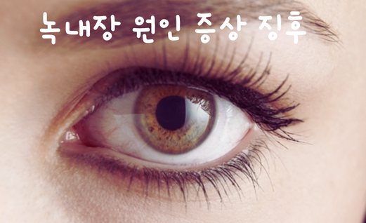  녹내장의 원인은 무엇일까요?녹내장 증상 및 징후 알아보자!