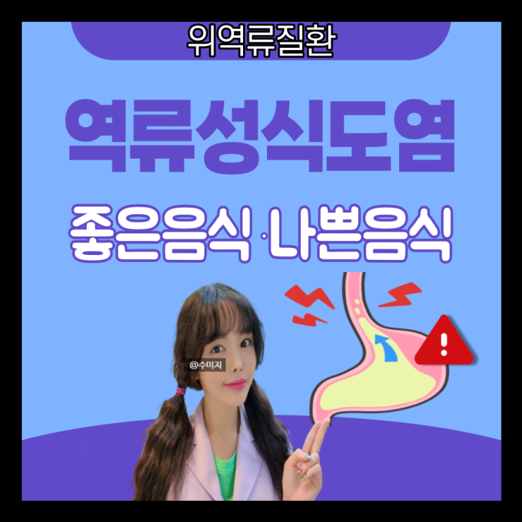  역류성 식도염 원인, 역류성식도염 좋은음식 안좋은 음식