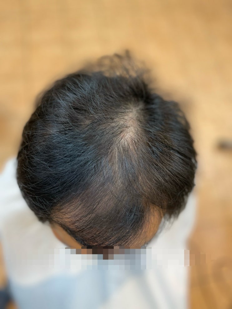  해운대구에서왔어요 세젤부 탈모성형펌 / 강서구 금정구 남구  동구 동래구  부산진구 북구 사상구  사하구 서구 수영구 연제구 중구에서도왔음요