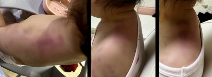안산 어린이집 아동학대 원장 CCTV 은폐했는데 불기소 카톡 마음편해요 안산 어린이집 아동학대 원장 CCTV 은폐했는데 불기소 카톡 마음편해요