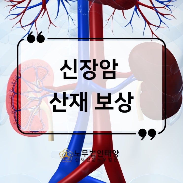  신장암 산재, 발암물질 노출됐는지 확인하세요