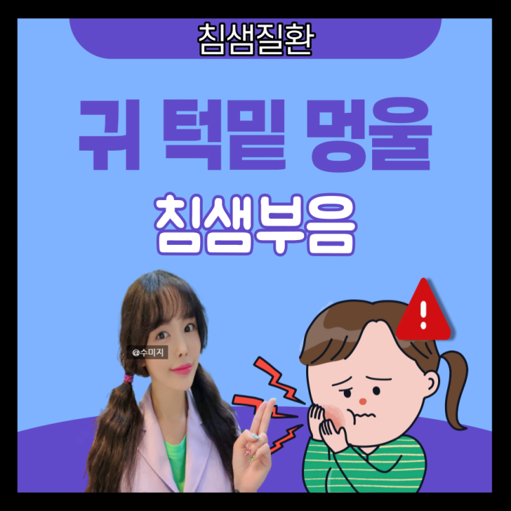  침샘염 침샘암 증상 : 침샘비대증 침샘 부음 귀뒤 목뒤 멍울 귀밑 턱밑 몽우리