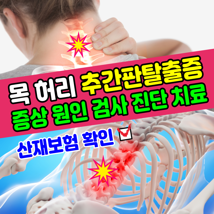  [기본정보] 목(경추) 허리(요추) 추간판 탈출증 디스크 증상, 원인, 검사, 진단, 치료 / 산재 신청 처리 보상