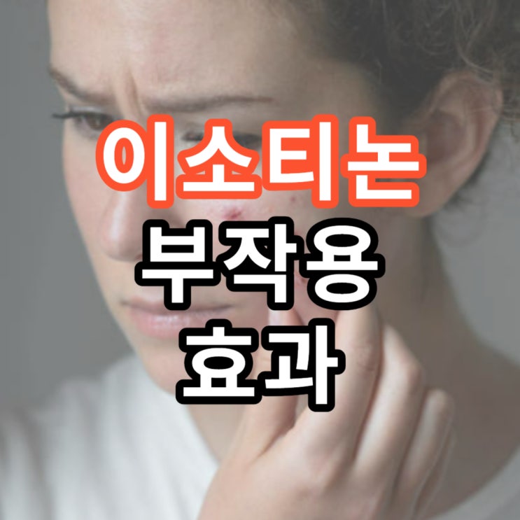  이소티논 부작용 효과 처방(피지조절제)