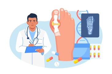  통풍 초기 증상과 정의 원인 치료와 좋은 음식 안 좋은 음식 관리 방법에 대해 알아보기