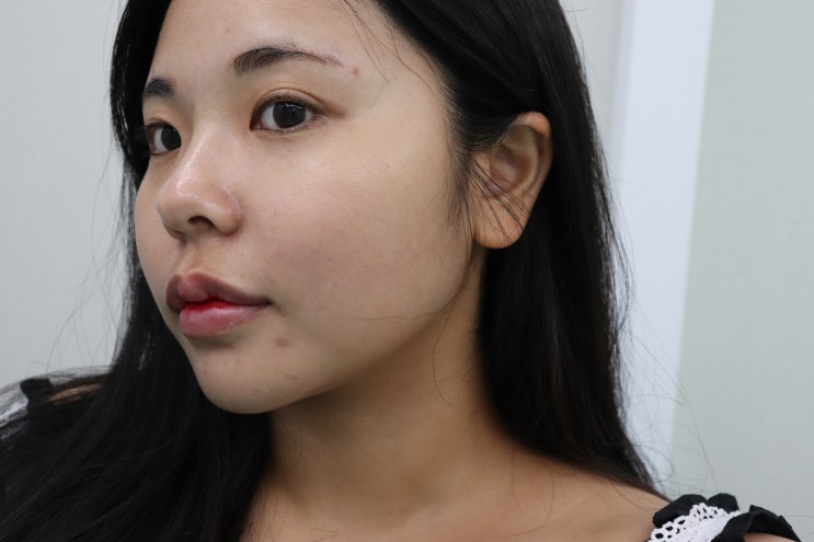진해 에스테틱 웨딩관리 필수 리프팅관리 , 고운빛깔 진해점 + 물광 리프팅 동시관리 + 즉각적 효과인증
