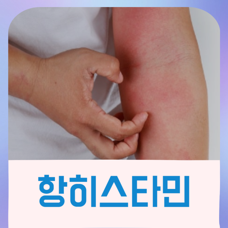  항히스타민 연고 히스타민 염증 치료법
