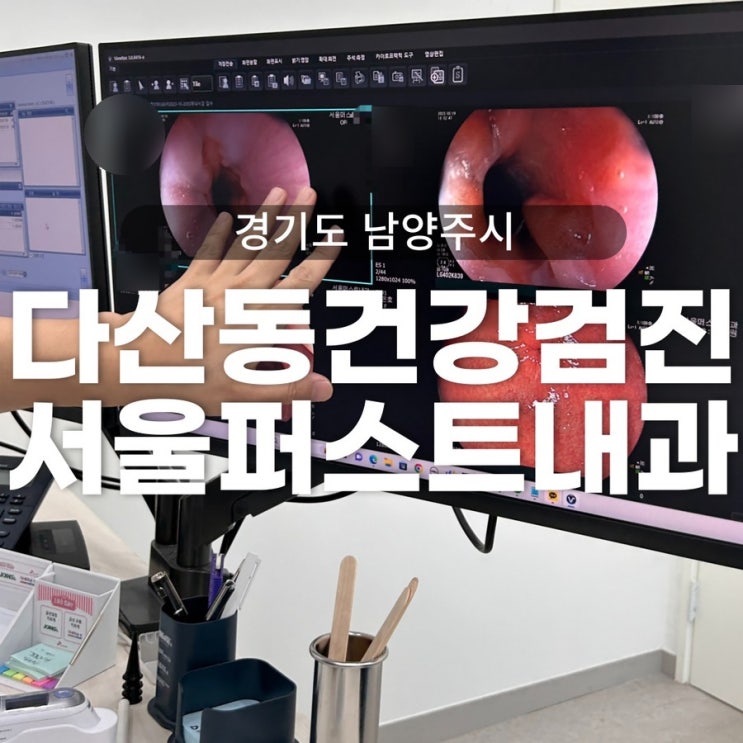 다산동 국가건강검진 서울퍼스트내과 - 수면 위내시경 솔직후기