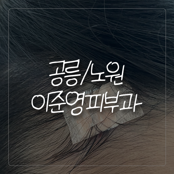 [공릉/노원] 서울성모병원 출신 피부과 전문의 선생님이 계신, 이준영피부과의원