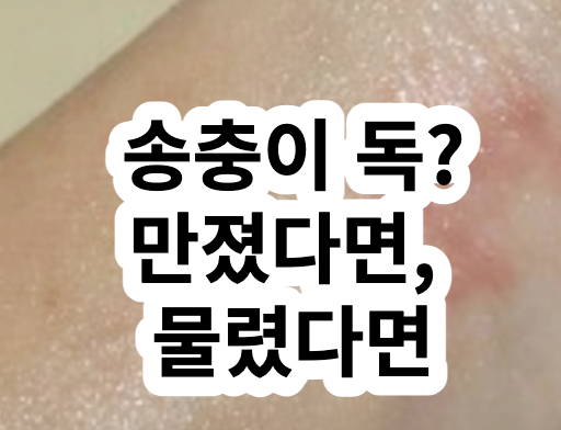 송충이 물림 독 퇴치 퇴치법 만지면 물리면 증상