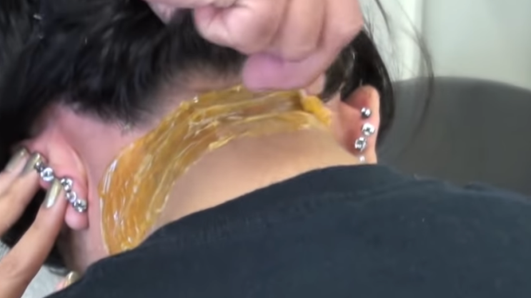  뒷목 왁싱의 필요성과 장점, 그리고 부작용 및 가격까지!