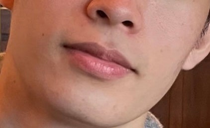  군대에 입대한 후 피부 변화
