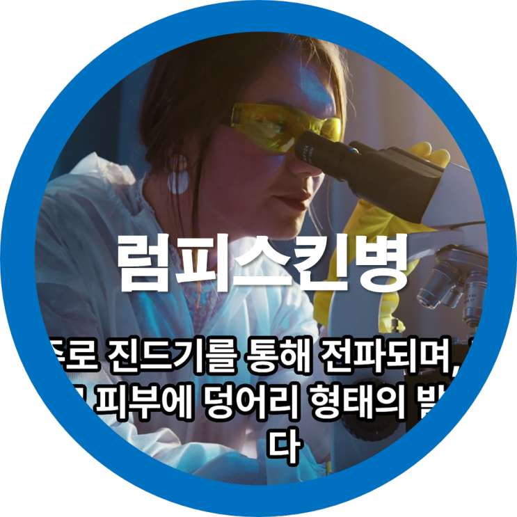  소 럼피스킨병이란 무엇이며 백신은 또 어떤게있을까요?